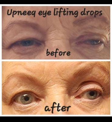 Upneeq ~ Amazing for Hooded and or Aging Eyes.... Helps to open and lift the eye lids for a more youthful appearance.....