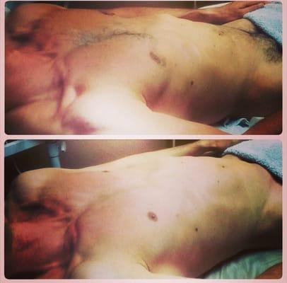 Chest / stomach & manzilian wax