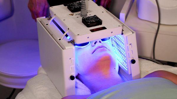 Blue LED light therapy to kill acne bacteria