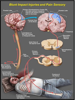 Custom Medical Illustration