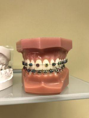 we specialize in braces.