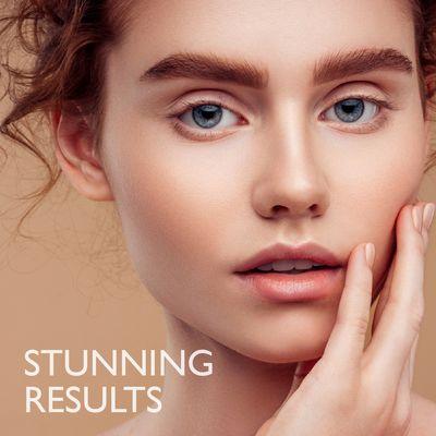 STUNNING results. Try The Body Deli Vital-C Serum today.