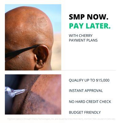 SMP NOW! PAY LATER! ( Scalp Micropigmentation)