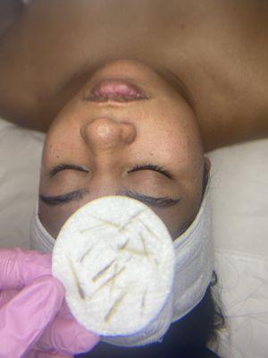 Dermaplaning Facial