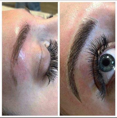 Before and after. Visit Infinibrow.com for more pictures.