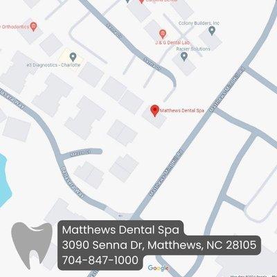 teeth whitening matthews nc