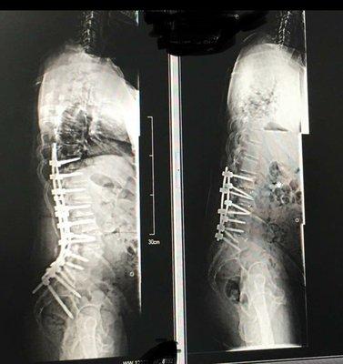 The left side is what was needed to correct the hot mess on the right.