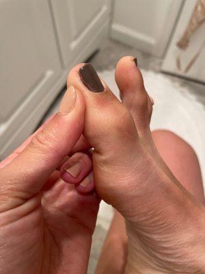 Uneven application on my toenail