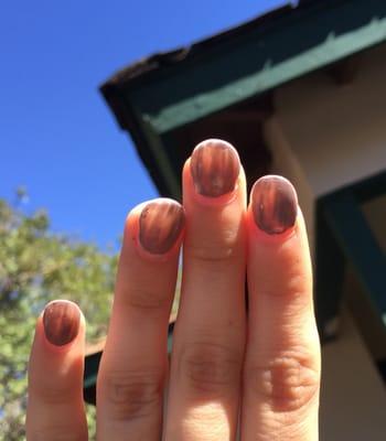 Poorly done acrylic manicure. This is after 4 days.