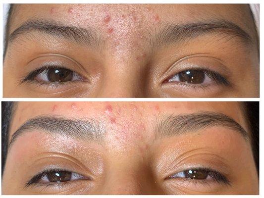 Before and after brow wax.