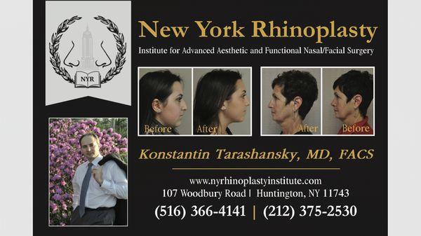 New York Rhinoplasty