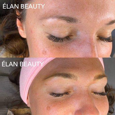 Microblading