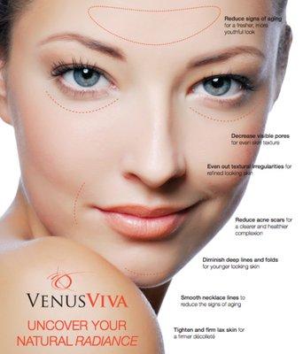 Venus Viva The Face Lift of The Future! Call us Today for more information! 516-277-2293