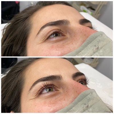 Lash Lift