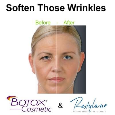 Botox & Dermal Fillers