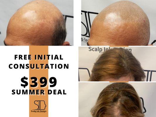 scalp micropigmentation special pricing $399 - free consultation