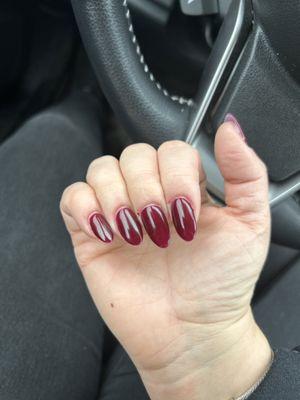 Bloody irritated cuticles, crooked nails