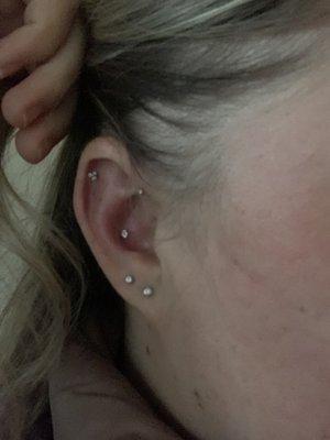 Fresh conch piercing