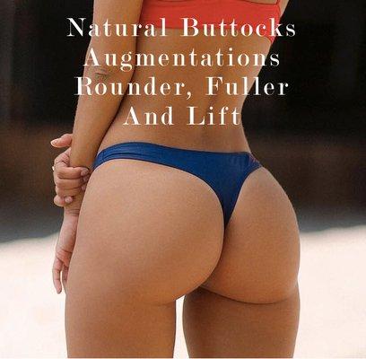 Natural BBL with Fat Grafting