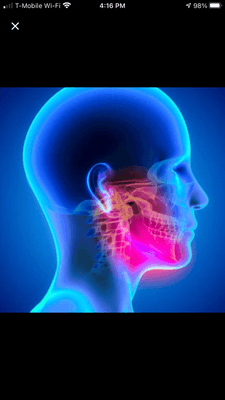 TMJ Massage encompasses the head, neck, and face.