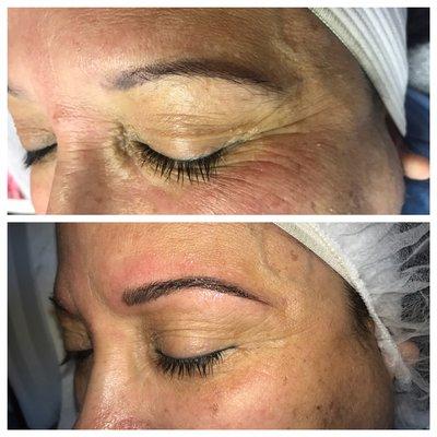 Microblading, Microneedling, Skin Tightening