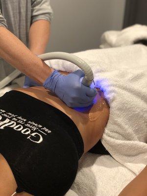 Cryoskin slimming treatment