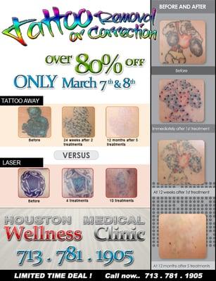 ALL Natural. Pain Free. Tattoo Removal.  3-4 Treatments 100% gone.