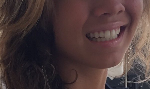 No photo editing needed- Glad My Periodontist takes care of my teeth