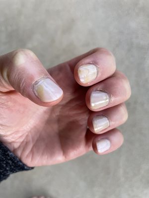 Reg Mani Essie Ballet Slippers, 3 days later, cuticles in better condition. Why did color change?