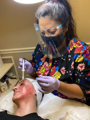 Lachhimi performing microneedling