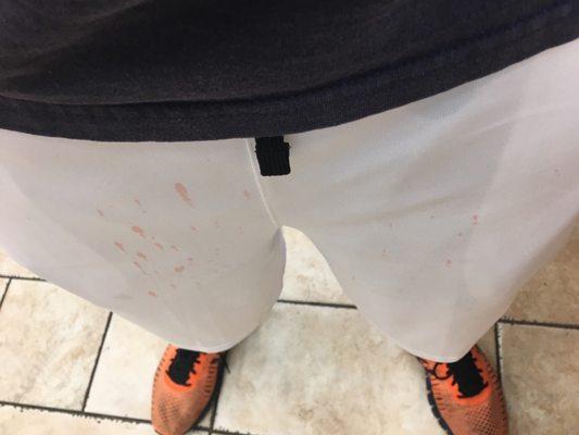 My pants after shooting myself with cherry syrup.