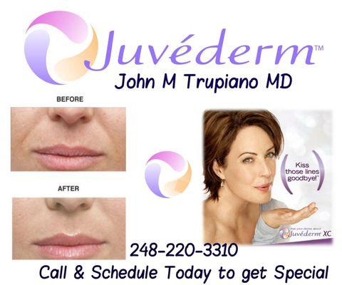 Natural Full Youthful #Lips, get your #pout back. Request a appointment at:  http://drtrupiano.com/contact-us/  Call  Office 248-220-3310