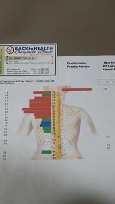 Thermal scan. White is normal,  and red is severe. I had lower back pain & my right leg was 1/4 inch off now shows being white