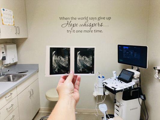 Delaware Institute for Reproductive Medicine -- first pregnancy scan Aug 2023