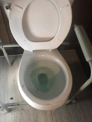 A Dirty toilet