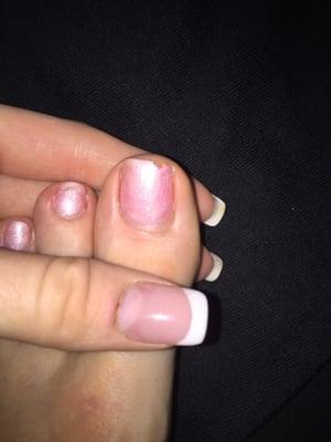 My chipped toenail after a couple days after getting them done, and little cuts on my fingernails after refill.