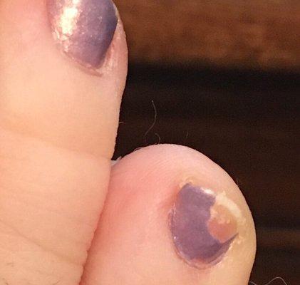 Pedicure on Monday, noticed this on Saturday. :(