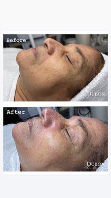 Dubon Skin Care