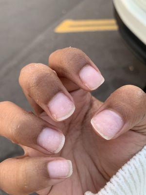 Horrible nail removal