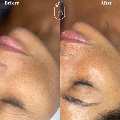 Hydrating Facial