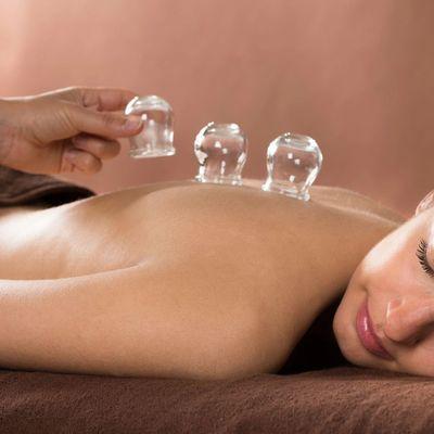 Cupping increases blood flow and quickens healing time of pain and other symptoms.