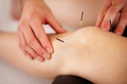 Revivify Acupuncture & Wellness