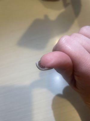 The cut under my nail