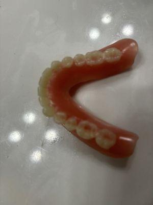 These are the yellow, jagged dentures initially made by Affordable Dentures. You can see the hallow, shallow back teeth.