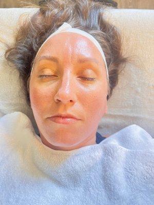 after dermaplanning facial