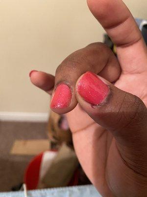 You can see where the dried up blood is on my thumb and middle and you can still see a little of the blood dried in the cuticle area.