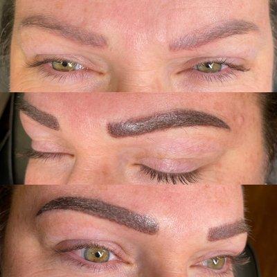 Brow correction