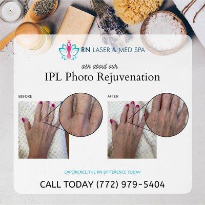 RN Laser & Med Spa