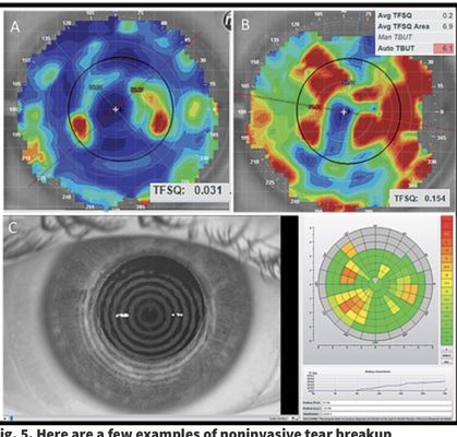 VSP, Eyemed, and Spectera Specialty Contact lens services