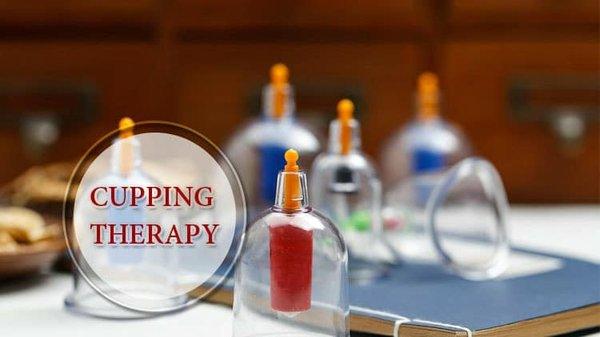 Cupping Therapy